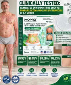 𝐌𝐎𝐏𝐑𝐎® 𝐈𝐋-𝟐𝟑𝐑 𝐀𝐧𝐭𝐚𝐠𝐨𝐧𝐢𝐬𝐭 𝐏𝐞𝐩𝐭𝐢𝐝𝐞 + 𝐈𝐧𝐝𝐢𝐫𝐮𝐛𝐢𝐧 𝟏𝟎-𝐈𝐍-𝟏 𝐍𝐚𝐧𝐨 𝐌𝐢𝐜𝐫𝐨𝐧𝐞𝐞𝐝𝐥𝐞 𝐏𝐚𝐭𝐜𝐡
