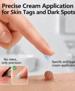 TERVENCE® 7-Day Cream for Skin Growths & Pigmentation Spots