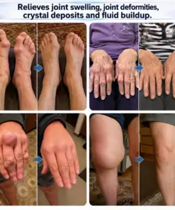 Tervence® 10-in-1 Joint & Muscle Care Roll-On