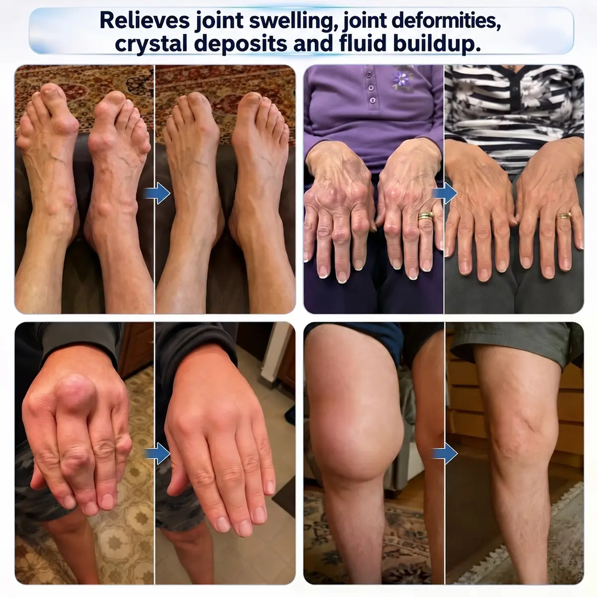 Tervence® 10-in-1 Joint & Muscle Care Roll-On