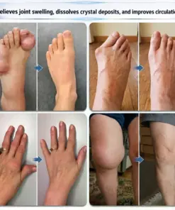 Tervence® 10-in-1 Joint & Muscle Care Roll-On