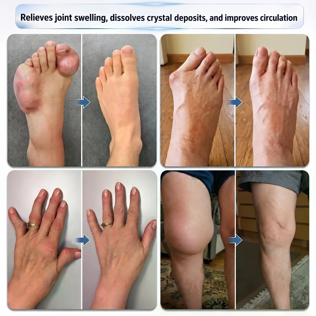 Tervence® 10-in-1 Joint & Muscle Care Roll-On