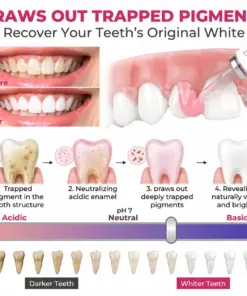 Tervence® Natural Enamel Restoration Gel for Cavity Repair